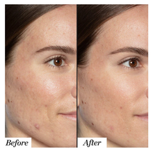 Load image into Gallery viewer, Sunday Riley Mini Good Genes Lactic Acid Treatment Face Serum 0.17 oz